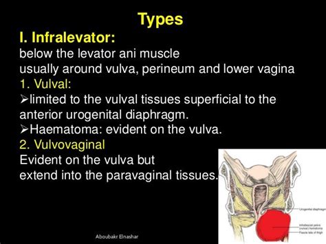 Puerperal Genital Haematomas