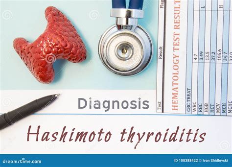 Endocrinology Diagnosis Hashimoto`s Thyroiditis Figure Of Thyroid