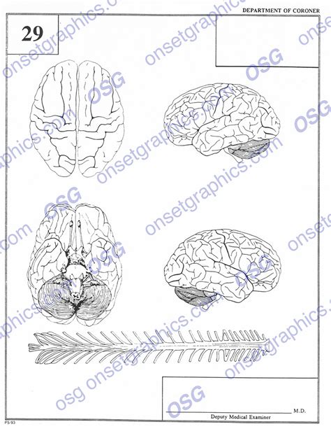 Autopsy Report Brain On Set Graphics