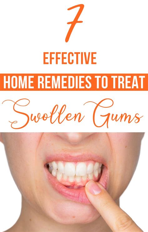 7 Effective Home Remedies To Treat Swollen Gums