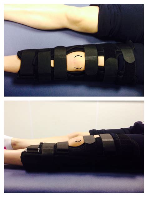 Soft Tissue Knee With Follow Up · Virtual Fracture Clinic