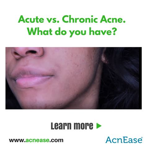 Acute Vs Chronic Acne How To Identify In Order To Treat Blog