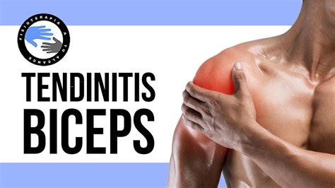 Qué es la tendinitis del bíceps Clínica Estemedic