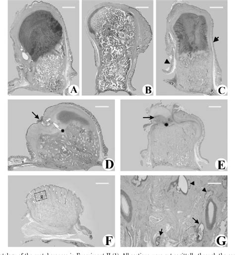 Figure 6 From Development Of A Nude Mouse Model For The Study Of