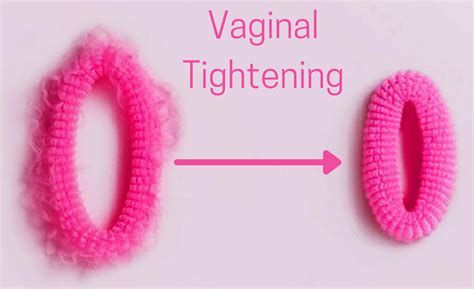 Vaginal Tightening Goodness Care