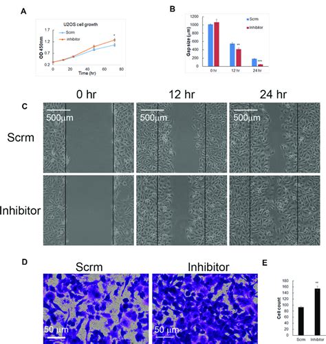 inhibiting mir 1225 5p increased u2os osteosarcoma cell growth download scientific diagram