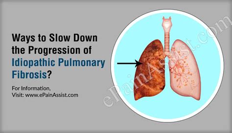 How To Slow Down The Progression Of Idiopathic Pulmonary Fibrosis