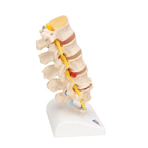 Anatomical Human Lumbar Vertebrae Skeleton Anatomy Degenerative Lumbar