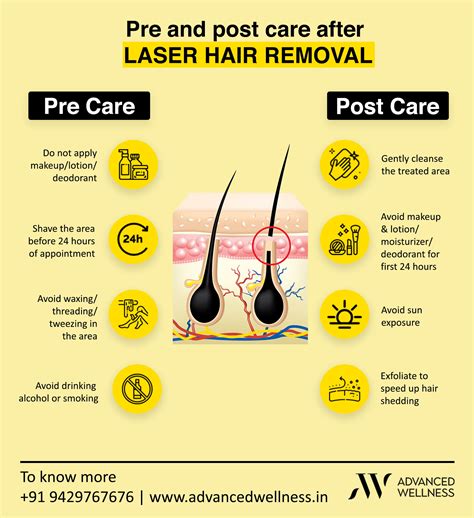 is laser hair removal permanent advanced wellness