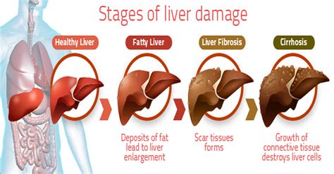 15 Warning Signs That Your Liver Isnt Functioning Properly