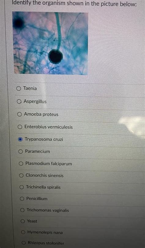 Solved Identify The Organism Shown In The Picture Below O Taenia Course Hero