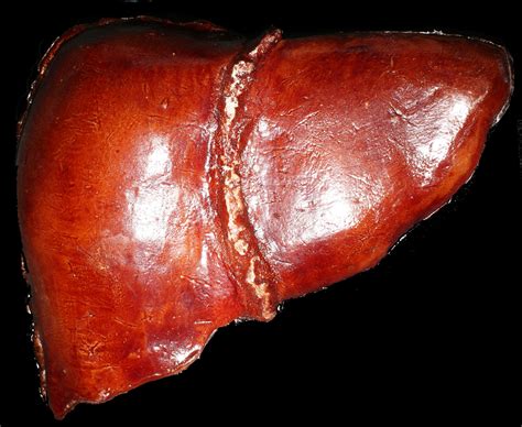 Human Liver Real Images