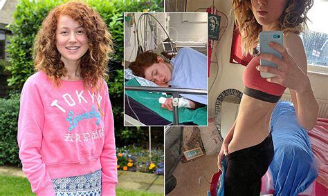Anorexic Girl Plummets To 6 Stone After Being Bullied For Having Red