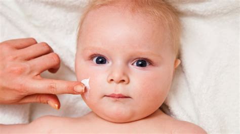 Dermatita Atopic La Copii Cauze Simptome Tratament