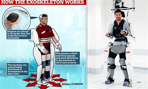 Paralysis Breakthrough As Man Can Move Using Exoskeleton Controlled By