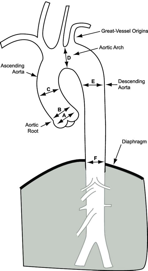 This Diagram Of The Thoracic Aorta Demonstrates The Segments Used For