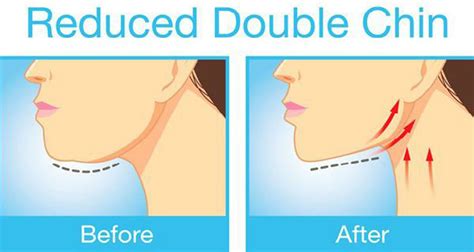 the best exercises for getting rid of that unwanted double chin and neck fat