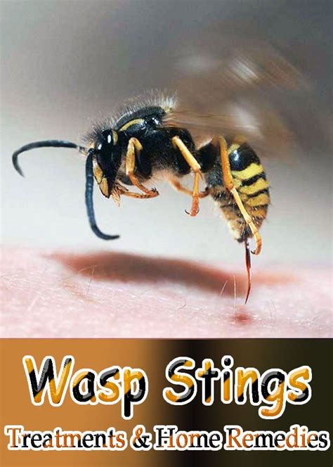 Although the stings look similar, they are quite different chemically. Wasp Stings: Treatments & Home Remedies | Wasp stings ...
