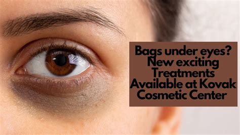 Non Surgical Eye Lifts In Chicago Under Eye Bags Removal Treatment