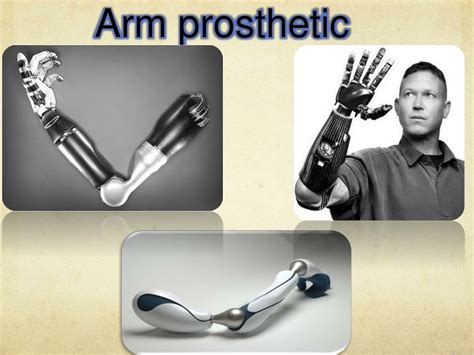ppt future of prosthetics powerpoint presentation free download id 5638932