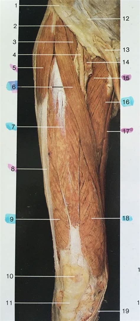 Right And Ventral Aspect Muscles Of Thigh 3 Iliopsoas 5 Tensor