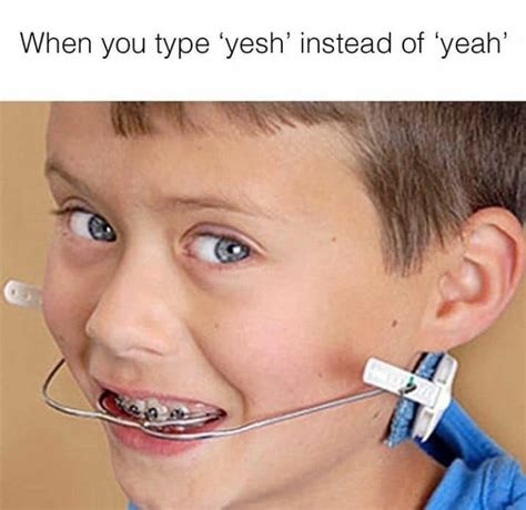 braces memes facebook