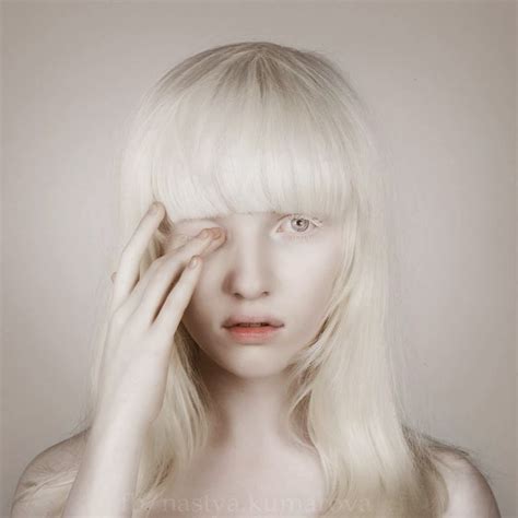 Natsya Kumarova Albino Model Albinism Beauty