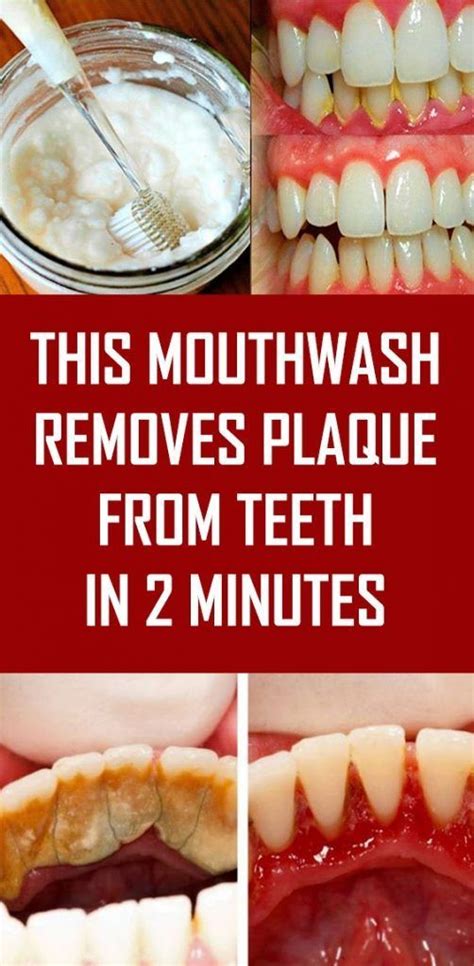 this mouthwash removes plaque from teeth in 2 minutes organic planner