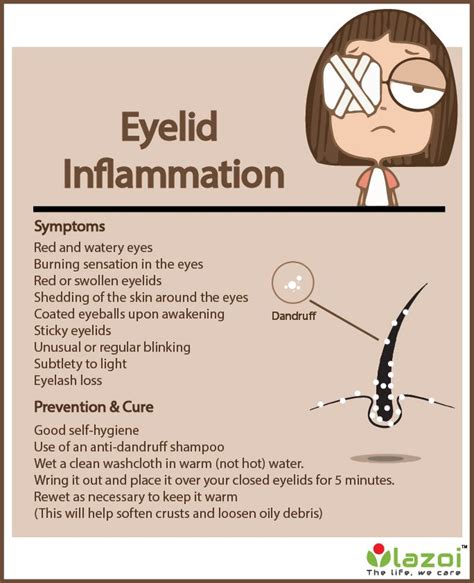 Swollen Eyelids What Are The Causes And Home Remedies For Swollen