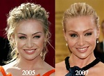Portia De Rossi Plastic Surgery Before And After - celebrity plastic ...