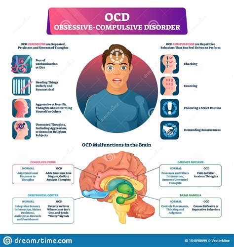 Ocd Obsessive Compulsive Disorder Labeled Explanation Vector