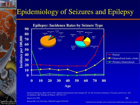 Ppt Clinical Epilepsy Powerpoint Presentation Free Download Id2399090