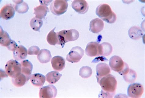 Kostenlose Bild dünn Film Mikroaufnahme Ring Formulare gametocytes Plasmodium falciparum