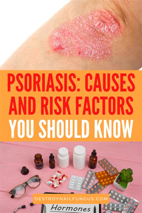What Causes Psoriasis Top 5 Risk Factors You Should Know About
