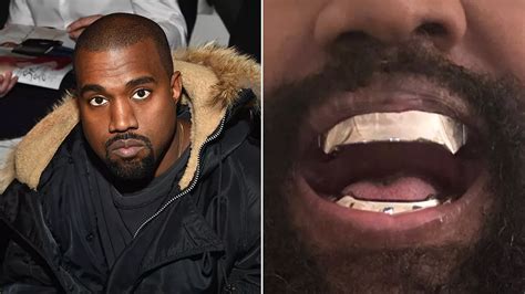 Kanye West Debuts Bizarre 850000 Titanium Grills After Having His