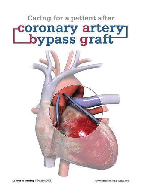 Cabg Nursing Heart Coronary Artery Bypass Surgery