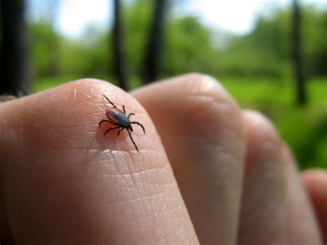 A Tick Bite Can Make You Allergic To Red Meatplenty Of People Have