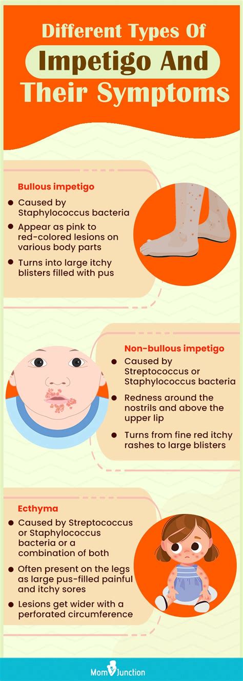 Impetigo In Babies Causes Symptoms Diagnosis And Treatment