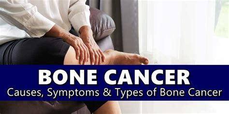 Bone Cancer Its Causes Symptoms And Types Of Bone Cancer Virality Facts