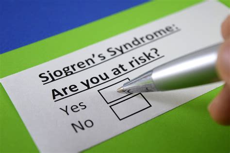 Sjögren Sendromu Romatoloji Ve İç Hastalıkları Uzmanı