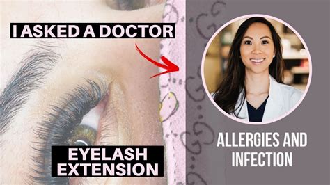 Lash Tech Vs Doctor Allergies And Infections About Eyelash Extension Must Watch Youtube