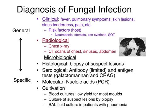 Ppt Fungi For Fellows Powerpoint Presentation Free Download Id4163423