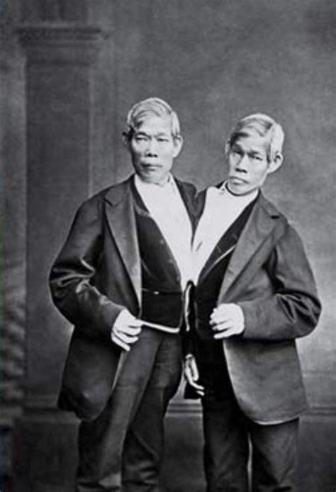 Chang And Eng Bunker Were A Pair Of Conjoined Twins Born In Siam Now