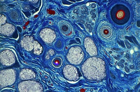 Skin Cells Under Microscope Labeled Micropedia Images And Photos Finder