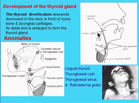 14 Development Of The Thyroid Gland Youtube