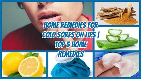 Is For Sale Brandbucket Cold Home Remedies Cold Sore