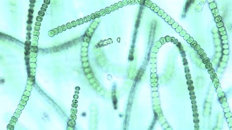 Microscope Microscopic View Microscope Blue Green Algae Micropedia
