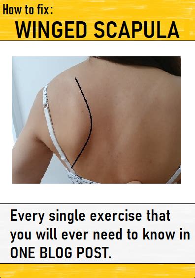 Pin By Suzanne On Scapula Winging Exercises Winged Scapula Scapula My