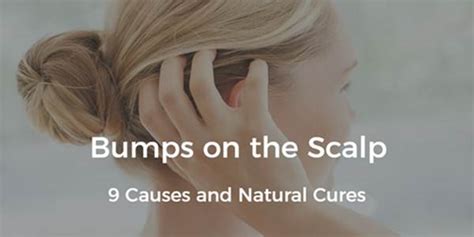 Bumps On Scalp 9 Causes And Natural Treatments Daily Health Cures