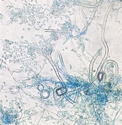 The Microscopic Morphology Of Aspergillus Versicolor Is Very